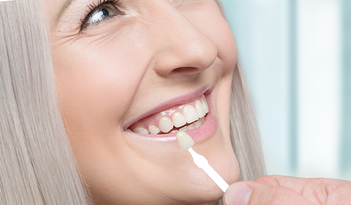 Image of a dental professional placing a veneer in a patient's mouth, at DeLuca, Ressel, & Congemi Dental Care in Spring Hill, FL.